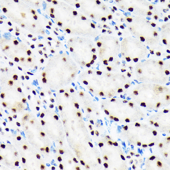 PBRM1 Rabbit mAb