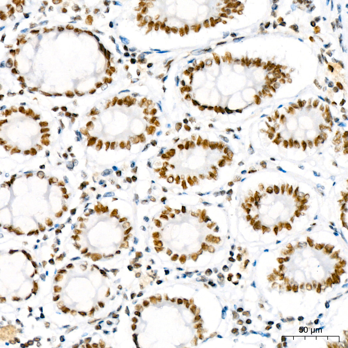PBRM1 Rabbit mAb