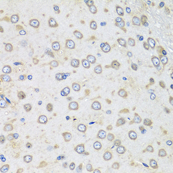 Albumin Rabbit pAb
