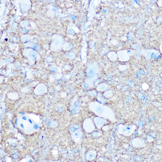 NCAM1 / CD56 Rabbit pAb