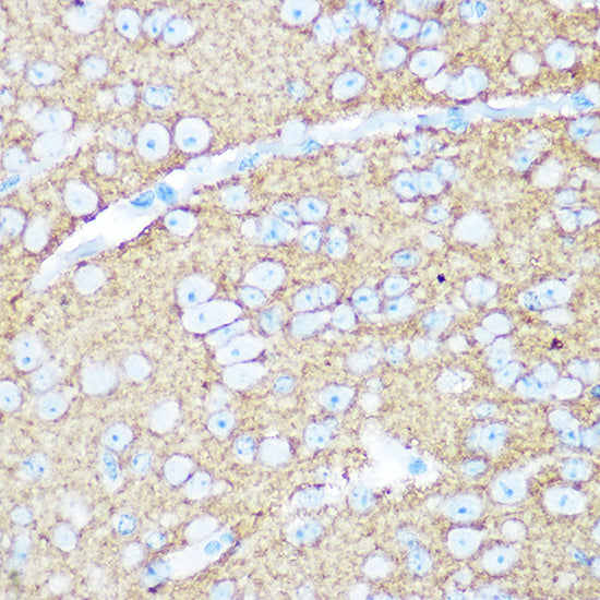 NCAM1 / CD56 Rabbit pAb