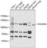 PLA2G4A Rabbit pAb