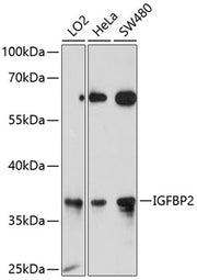 IGFBP2 Rabbit pAb