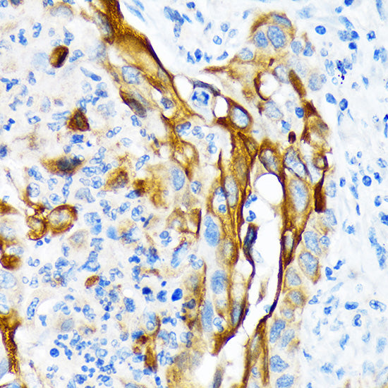 Cytokeratin 13 (KRT13) Rabbit mAb