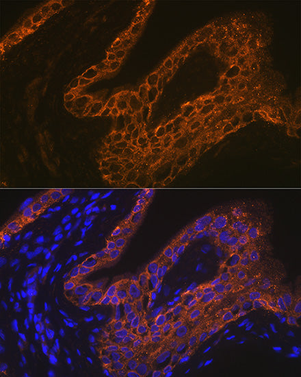 Cytokeratin 13 (KRT13) Rabbit mAb