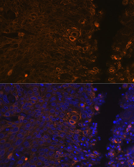 Cytokeratin 13 (KRT13) Rabbit mAb
