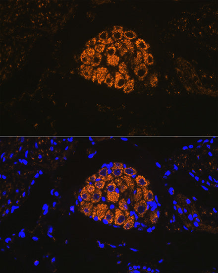 Cytokeratin 13 (KRT13) Rabbit mAb