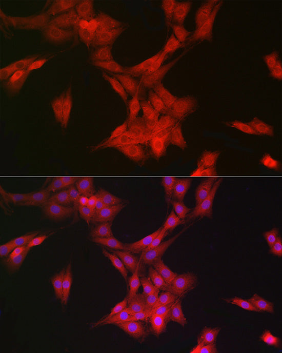 MRPL28 Rabbit mAb
