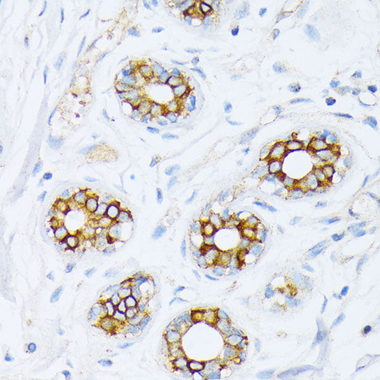 Fatty Acid Synthase (FASN) Rabbit pAb