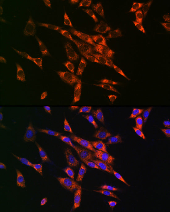 Fatty Acid Synthase (FASN) Rabbit pAb
