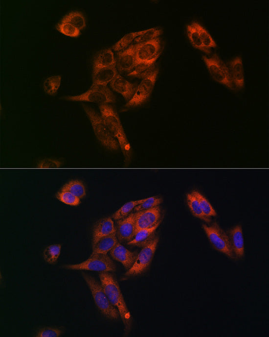 Fatty Acid Synthase (FASN) Rabbit pAb