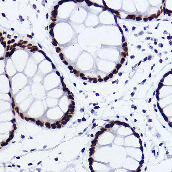 CTBP2 Rabbit mAb