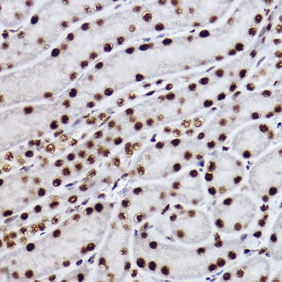 CTBP2 Rabbit mAb