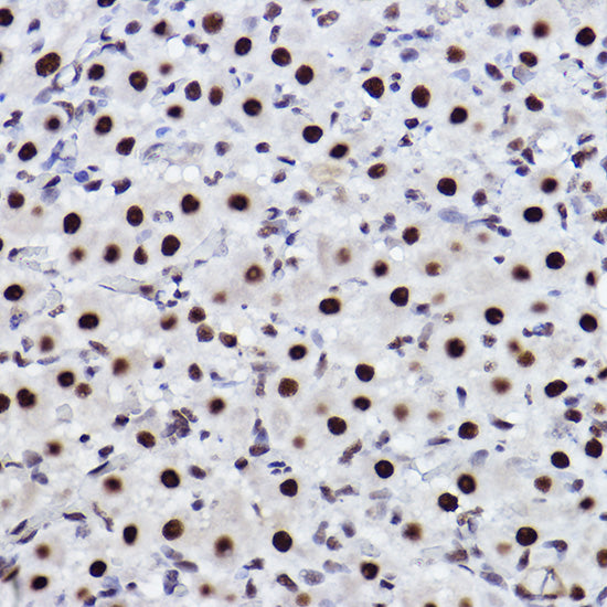 CTBP2 Rabbit mAb