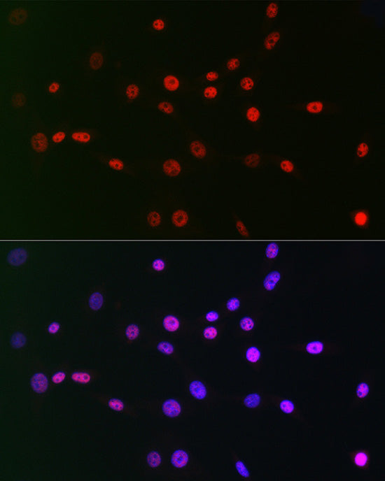 CTBP2 Rabbit mAb