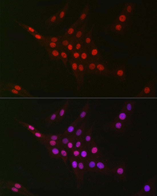 CTBP2 Rabbit mAb