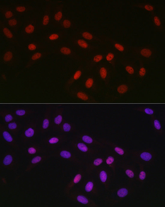 CTBP2 Rabbit mAb