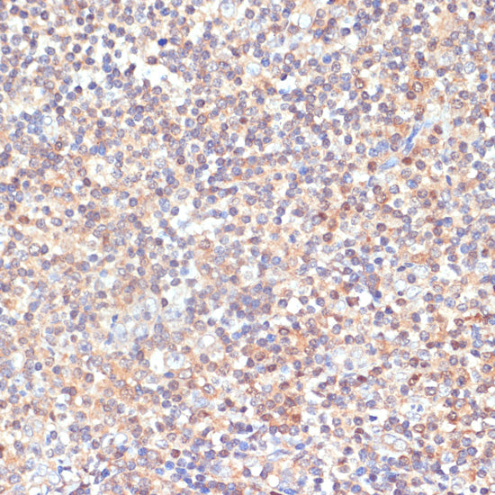 PKC delta Rabbit pAb