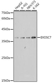EXOSC7 Rabbit mAb