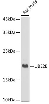 UBE2B Rabbit mAb