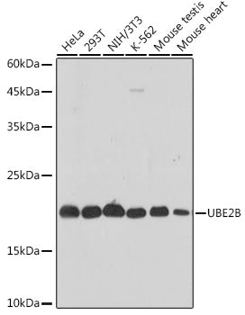 UBE2B Rabbit mAb