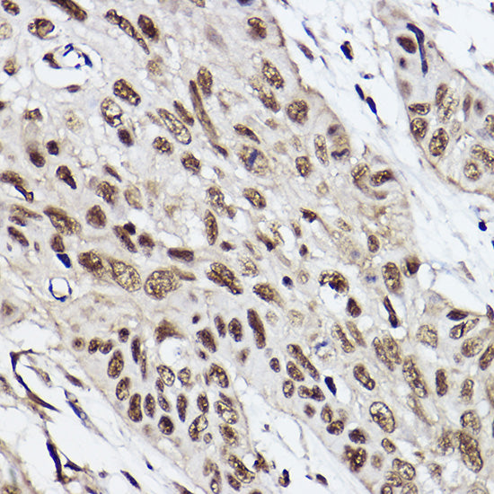UBE2B Rabbit mAb
