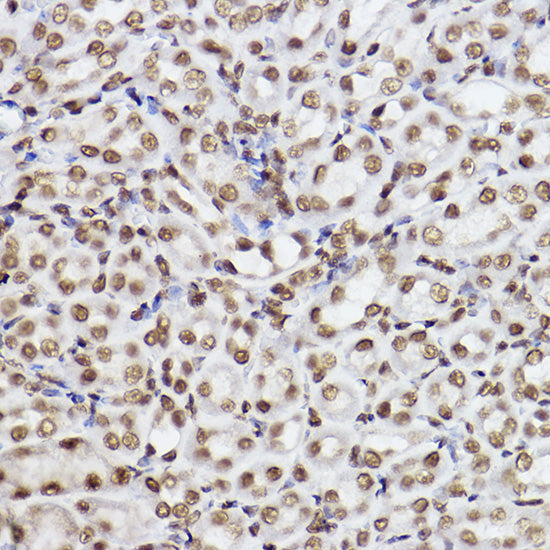 UBE2B Rabbit mAb