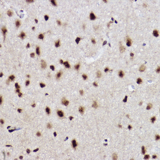 UBE2B Rabbit mAb