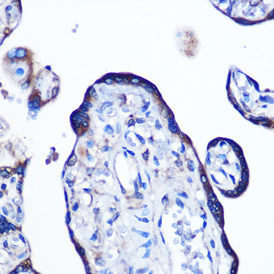 Alkaline Phosphatase (ALPL) Rabbit mAb
