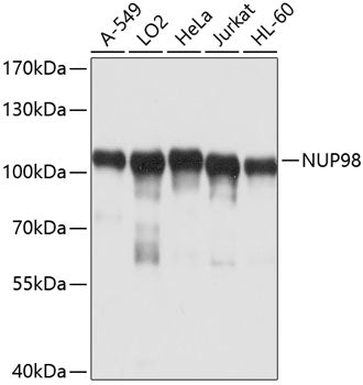 NUP98 Rabbit pAb