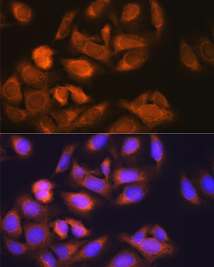 [KO Validated] HK1 Rabbit mAb