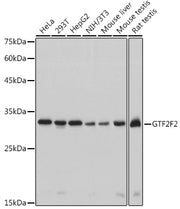 GTF2F2 Rabbit mAb
