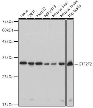 GTF2F2 Rabbit mAb