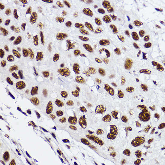 GTF2F2 Rabbit mAb