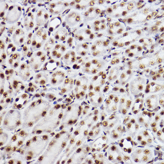 GTF2F2 Rabbit mAb