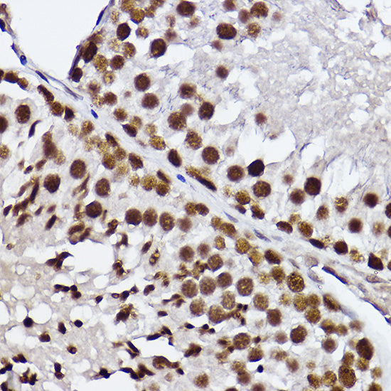 GTF2F2 Rabbit mAb