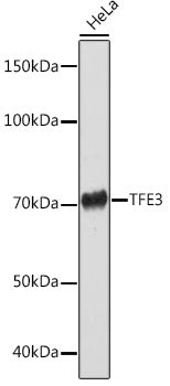 TFE3 Rabbit mAb