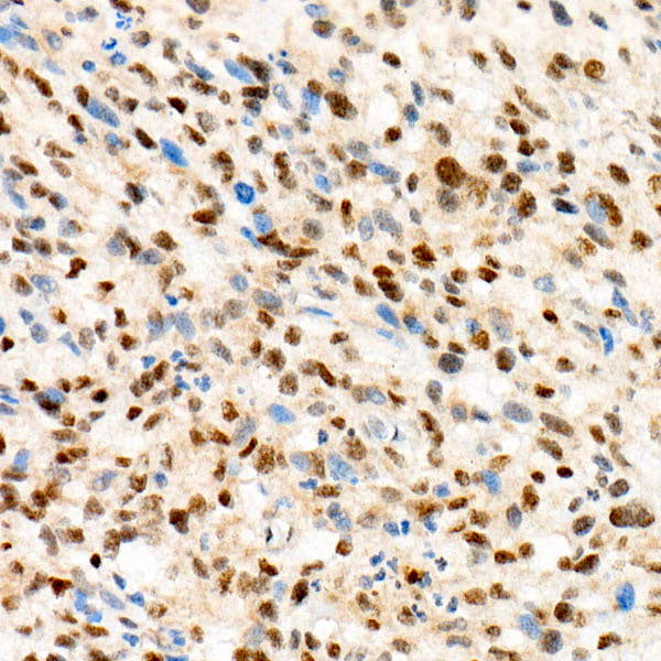 TFE3 Rabbit mAb