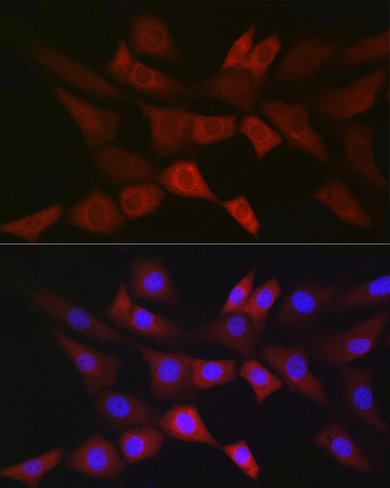 PGD Rabbit mAb