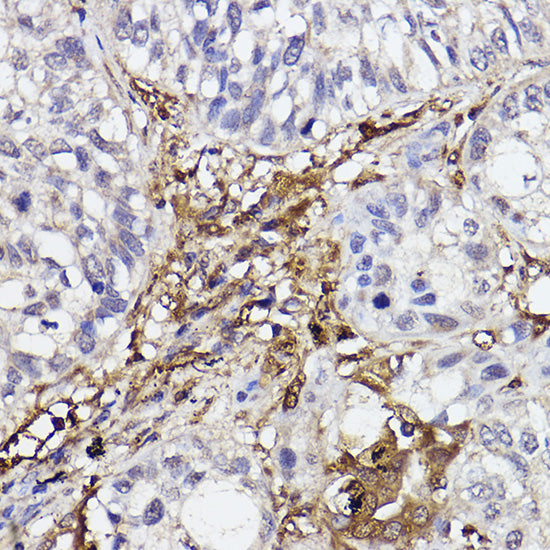GBP1 Rabbit mAb