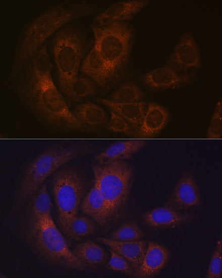 Pumilio 1 Rabbit mAb
