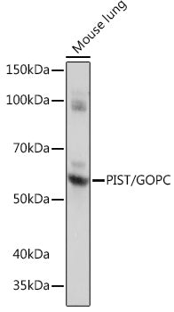 PIST/GOPC Rabbit mAb