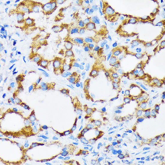PIST/GOPC Rabbit mAb