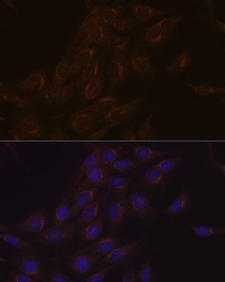 PIST/GOPC Rabbit mAb