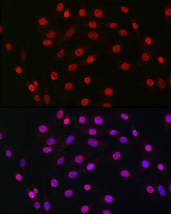 HDGF Rabbit mAb