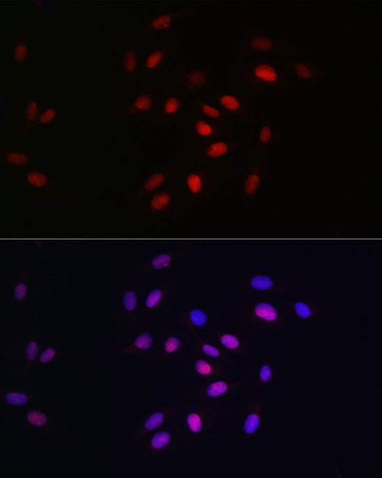 HDGF Rabbit mAb
