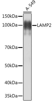 [KO Validated] LAMP2 Rabbit mAb