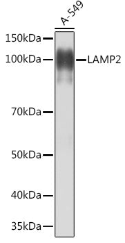 [KO Validated] LAMP2 Rabbit mAb