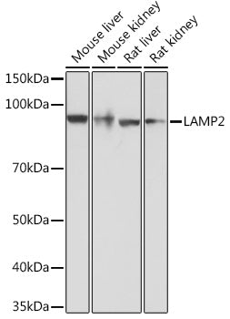 [KO Validated] LAMP2 Rabbit mAb