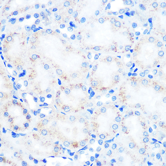 [KO Validated] LAMP2 Rabbit mAb